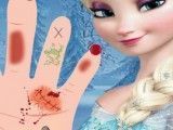 Cuidar da mãozinha da Elsa