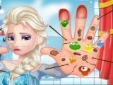 Elsa cuidar das mãos feridas