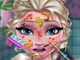 Médico do rosto da Elsa
