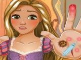 Rapunzel ferimentos da mão