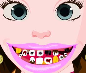 Anna Frozen no dentista