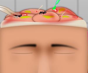 Cirurgia na cabeça