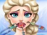 Dentista da Frozen Elsa